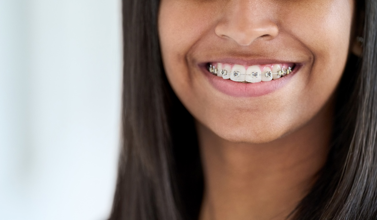 Close-up portrait of a smiling young woman with braces.