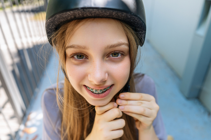 Braces and Sports: Mouthguards, Impacts, and Playing Safe